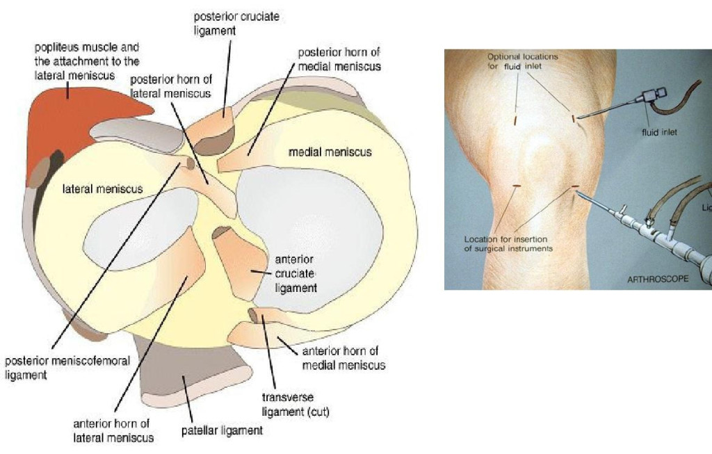 knee-arthroscopy-knee-and-hip-website